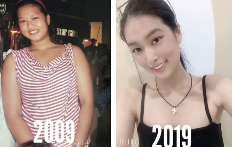 Khi Hoa - Á hậu cũng có khuyết điểm: Thùy Tiên đầy vết rạn da, Phương Nhi không thể sửa - 1